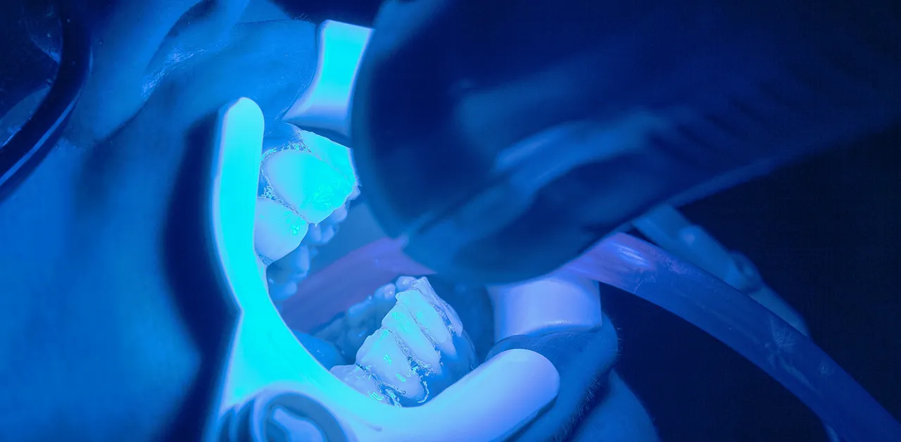 Dentalni turizam u Novom Sadu, od 3D snimka do novog osmeha